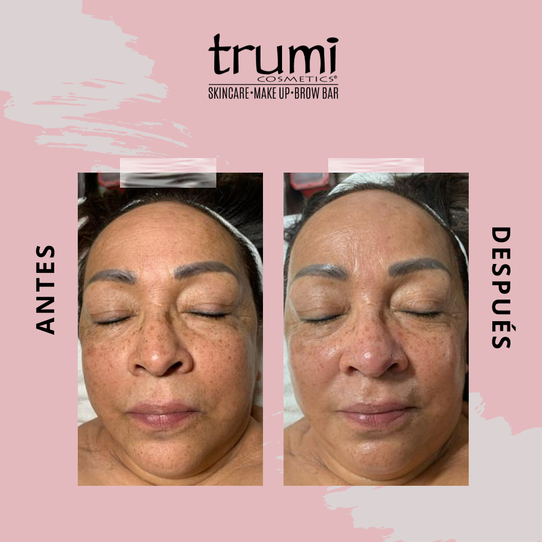 Antes y Despues Hydradefense con Trumi Cosmetics