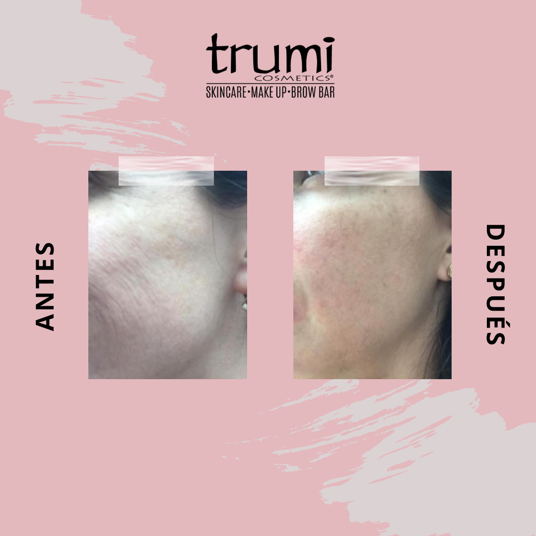 Antes y Despues Hydradefense con Trumi Cosmetics