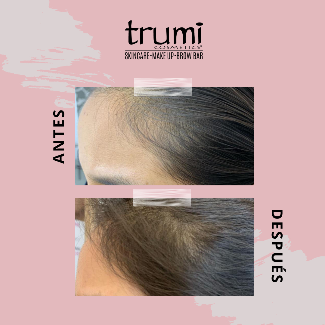 Antes y Despues Promo Papa Trumi Cosmetics