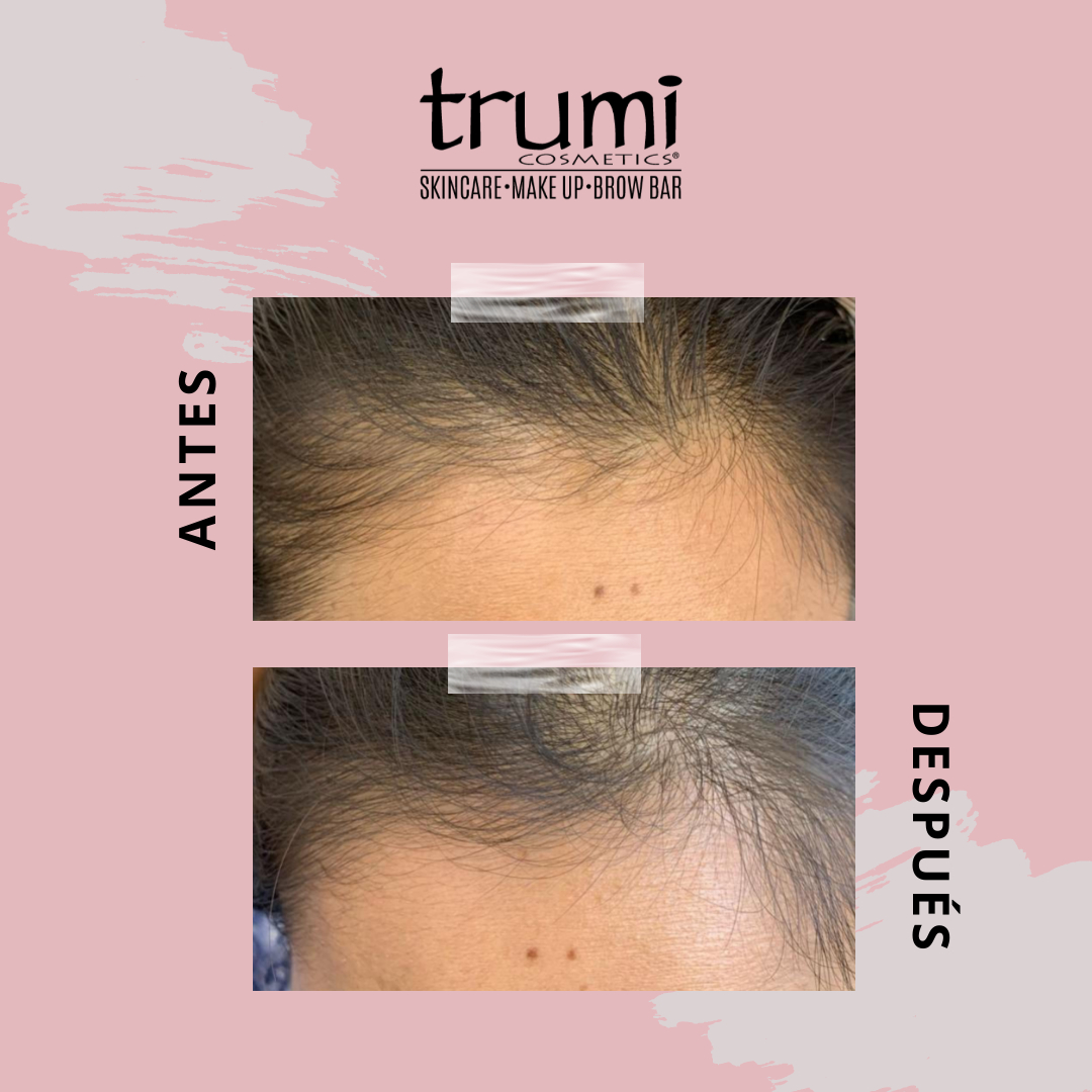 Antes y Despues Promo Papa Trumi Cosmetics