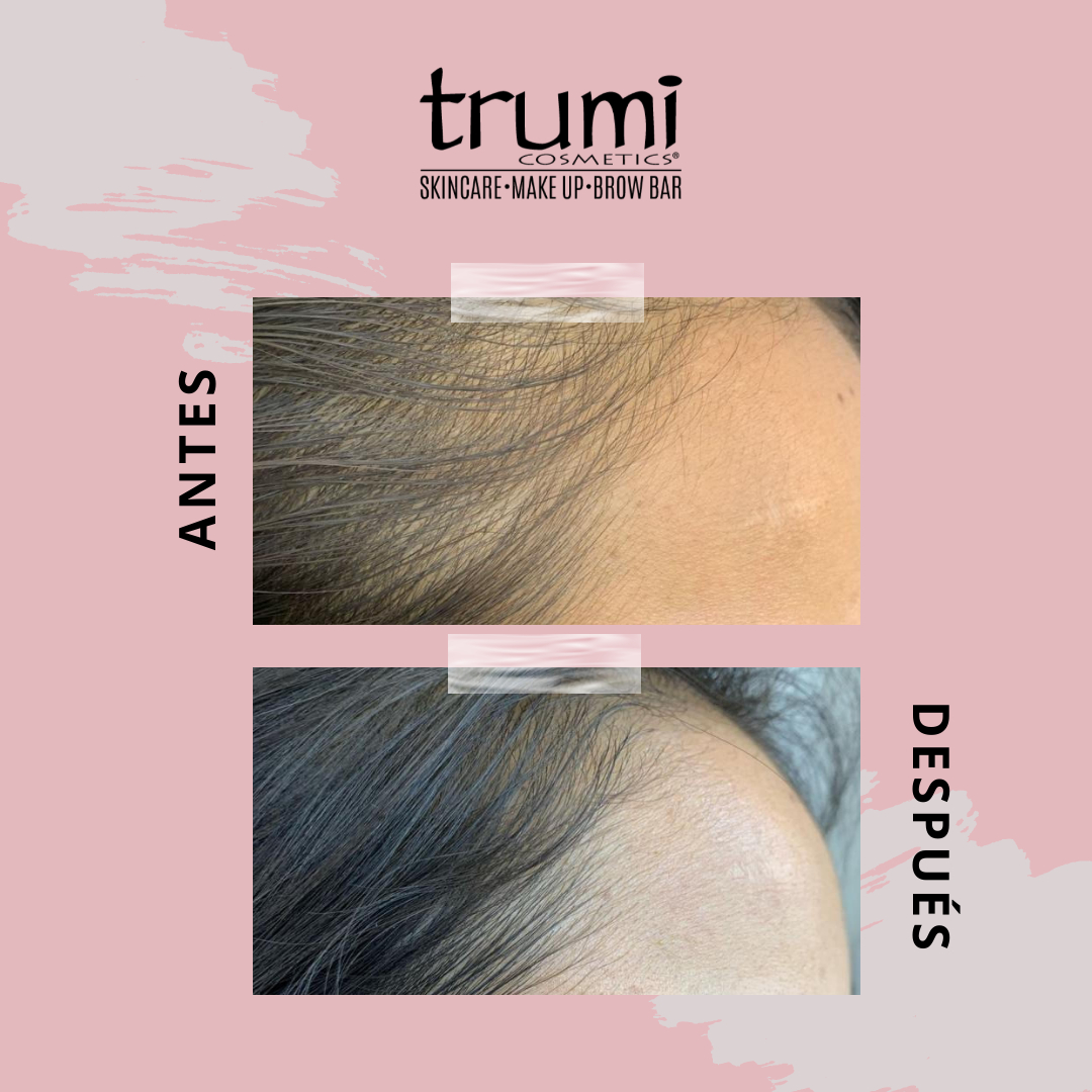 Antes y Despues Promo Papa Trumi Cosmetics