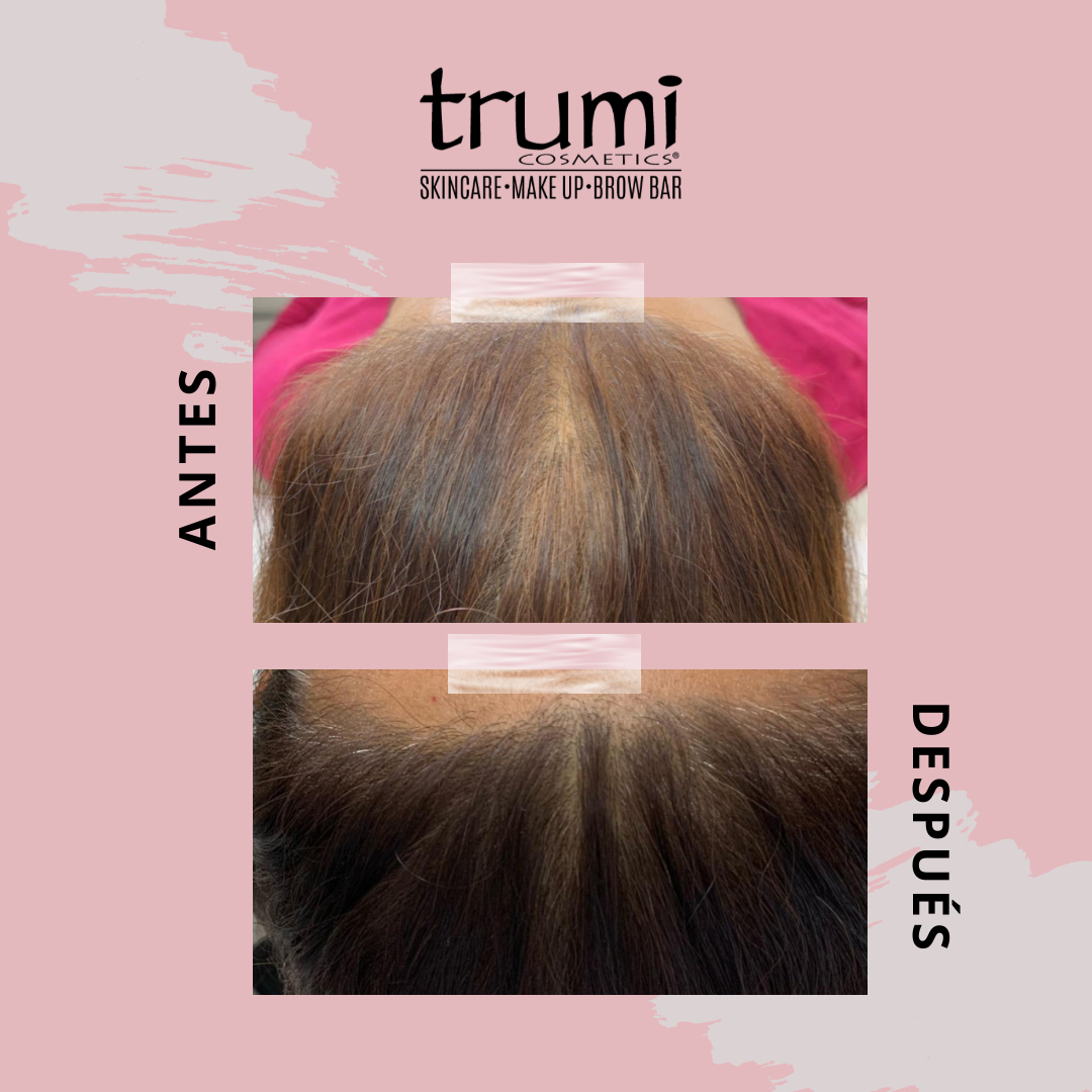 Antes y Despues Keravive con Trumi Cosmetics