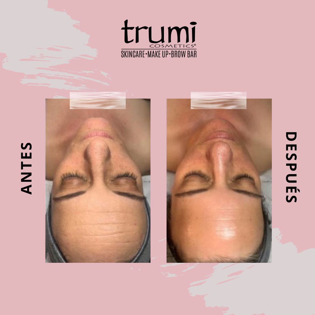 Antes y Despues Your Time con Trumi Cosmetics